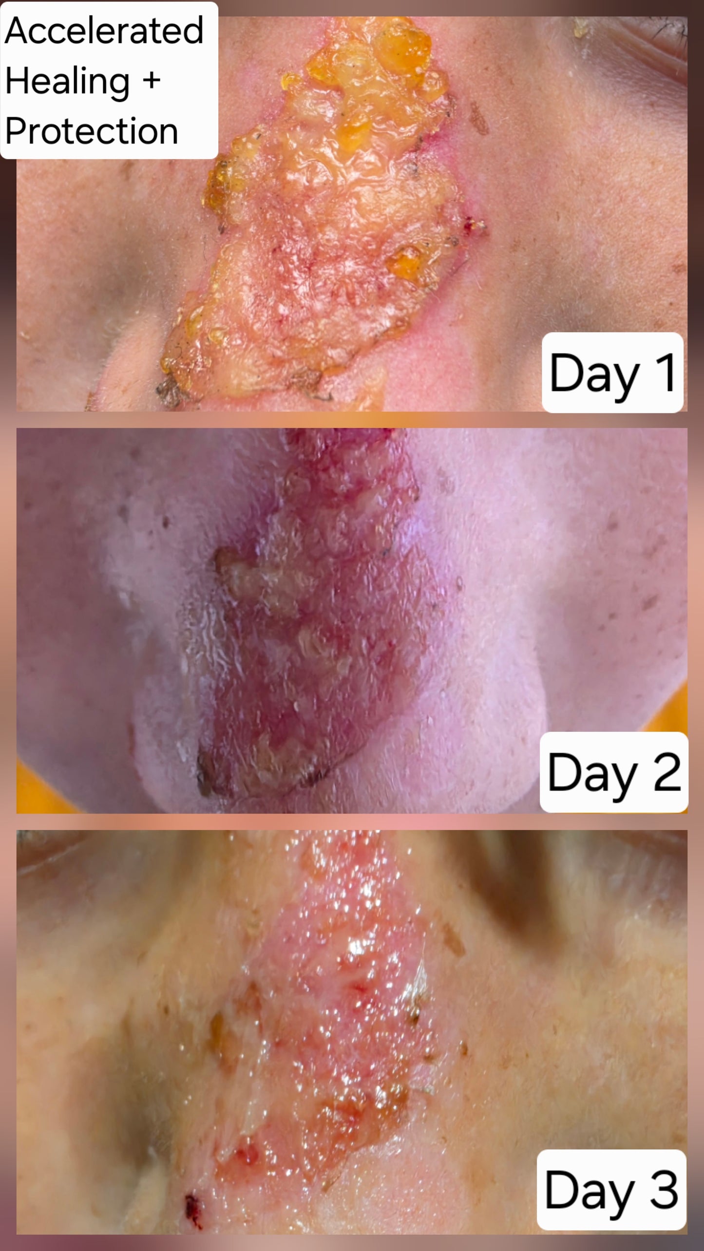 Progression of wound healing over three days with visible changes.